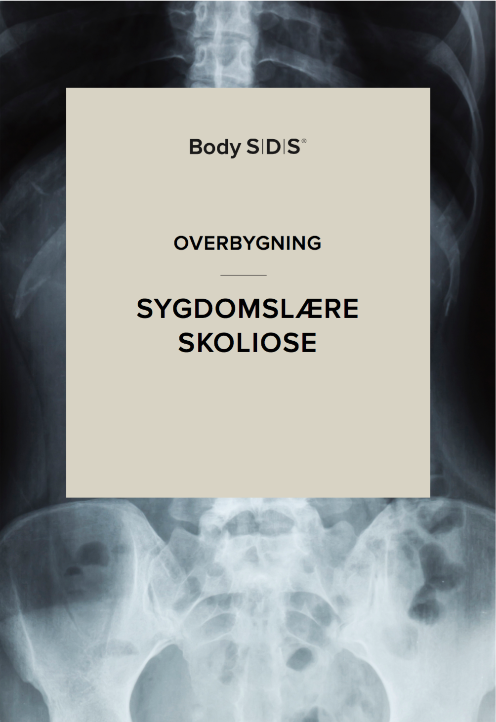 Overbygning-body-sds